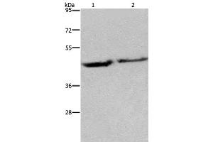 Western Blot analysis of Human adrenal pheochromocytoma and fetal brain tissue using EIF3H Polyclonal Antibody at dilution of 1:1150 (EIF3H Antikörper)