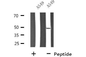 Western blot analysis of extracts from A549 cells, using SLC30A4 antibody. (SLC30A4 Antikörper  (Internal Region))