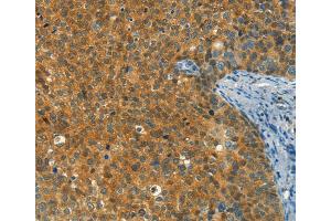 Immunohistochemistry (IHC) image for anti-DIRAS Family, GTP-Binding RAS-Like 1 (DIRAS1) antibody (ABIN2432953) (DIRAS1 Antikörper)