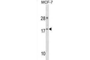 Western Blotting (WB) image for anti-Cyclin-Dependent Kinase 2 Associated Protein 2 (CDK2AP2) antibody (ABIN3000904) (CDK2AP2 Antikörper)