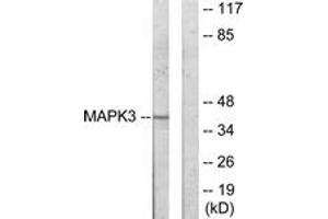 Western Blotting (WB) image for anti-Mitogen-Activated Protein Kinase-Activated Protein Kinase 3 (MAPKAPK3) (AA 301-350) antibody (ABIN2889621) (MAPKAP Kinase 3 Antikörper  (AA 301-350))