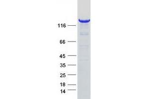 Western Blotting (WB) image for Aldehyde Oxidase 1 (AOX1) protein (Myc-DYKDDDDK Tag) (ABIN2714534)