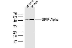 Mouse spleen and bone lysates probed with Rabbit Anti-SIRP Alpha Polyclonal Antibody, Unconjugated  at 1:500 for 90 min at 37˚C. (SIRPA Antikörper  (AA 151-250))