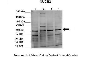 Lanes: Lane 1:541 µg HEK293 lysate  Lane 2: 041 µg MDCK lysate   ane 3: 041 µg NMuMG lysate   ane 4: 041 µg MDAMB231 lysate Primary Antibody Dilution: 1:0000Secondary Antibody: Goat anti-rabbit-Alexa Fluor 680 Secondary Antibody Dilution: 1:00,000  Gene Name: NUCB2 Submitted by: Dr. (NUCB2 Antikörper  (Middle Region))