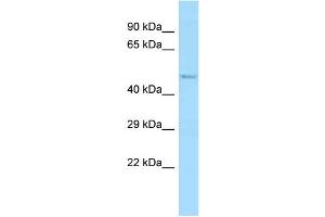 WB Suggested Anti-Abi1 Antibody Titration: 1. (ABI1 Antikörper  (N-Term))