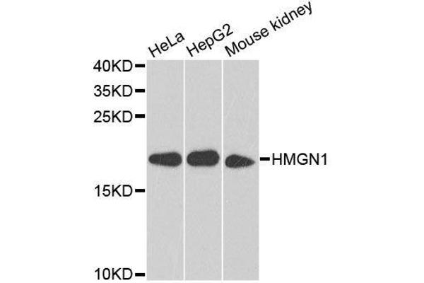 HMGN1 Antikörper  (AA 1-100)