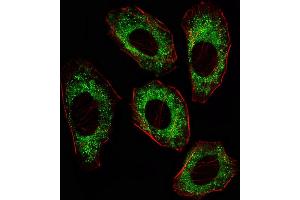 Fluorescent image of A549 cell stained with SRC Antibody (ABIN387822 and ABIN2843908)/SD41014A. (Src Antikörper)