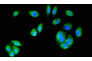 Immunofluorescent analysis of A549 cells using ABIN7146988 at dilution of 1:100 and Alexa Fluor 488-congugated AffiniPure Goat Anti-Rabbit IgG(H+L) (CTNND1 Antikörper  (AA 482-605))