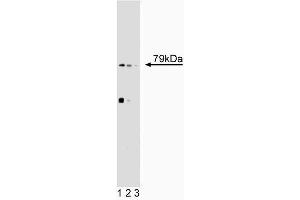 Western blot analysis of 5-Lipoxygenase on SL-29 lysate. (ALOX5 Antikörper  (AA 442-590))
