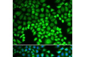 Immunofluorescence analysis of U2OS cells using PSMA4 Polyclonal Antibody (PSMA4 Antikörper)