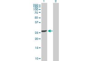 Western Blot analysis of DCK expression in transfected 293T cell line by DCK MaxPab polyclonal antibody. (DCK Antikörper  (AA 1-260))