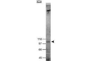 Western blot analysis of NOD2 in NOD2 transfected HEK 293T (Bosc 23) cell lysate with NOD2 monoclonal antibody, clone 2D9 .