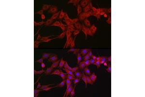 Immunofluorescence analysis of PC-12 cells using LTBR Rabbit pAb (ABIN6129412, ABIN6143379, ABIN6143381 and ABIN6220987) at dilution of 1:200 (40x lens). (LTBR Antikörper  (AA 31-227))