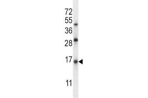 Western Blotting (WB) image for anti-Surfactant Protein C (SFTPC) antibody (ABIN2997467) (Surfactant Protein C Antikörper)