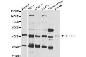 Western blot analysis of extracts of various cell lines, using MTERFD1 antibody (ABIN6293949) at 1:1000 dilution. (MTERFD1 Antikörper)