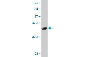 Western Blot detection against Immunogen (42. (ZMAT4 Antikörper  (AA 1-153))