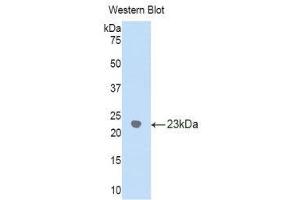 Western Blotting (WB) image for anti-gamma Glutamyltransferase 1 (GGT1) (AA 122-299) antibody (ABIN1859003) (GGT1 Antikörper  (AA 122-299))