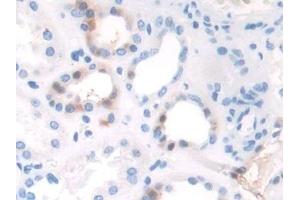 Immunohistochemistry (IHC) image for anti-TAF1 RNA Polymerase II, TATA Box Binding Protein (TBP)-Associated Factor, 250kDa (TAF1) (AA 1379-1636) antibody (ABIN7439966)