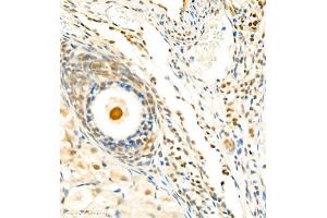 Immunohistochemistry of paraffin embedded mouse ovary using Skar (ABIN7074970) at dilution of 1:1800 (400x lens) (p46 Antikörper)