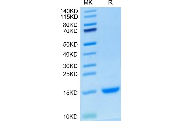 CCL2 Protein (AA 24-99) (His tag)