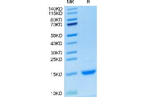 Cynomolgus MCP-1 on Tris-Bis PAGE under reduced condition. (CCL2 Protein (AA 24-99) (His tag))
