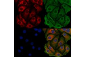 ABIN6259741 and ABIN6279518 staining Hela cells by IF/ICC.