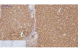 Immunohistochemistry of paraffin-embedded Human liver tissue using COL3A1 Monoclonal Antibody at dilution of 1:200. (COL3A1 Antikörper)