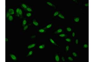 Immunofluorescence (IF) image for anti-SWI/SNF Related, Matrix Associated, Actin Dependent Regulator of Chromatin, Subfamily D, Member 1 (SMARCD1) (AA 7-124) antibody (ABIN7171071)
