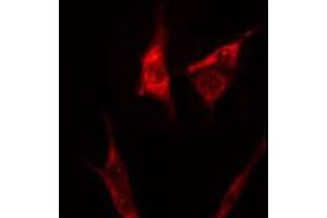 ABIN6275263 staining 293 cells by IF/ICC. (Myosin Antikörper  (Internal Region))