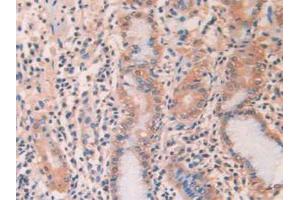 IHC-P analysis of Human Stomach Tissue, with DAB staining. (SERPINA1 Antikörper  (AA 25-418))