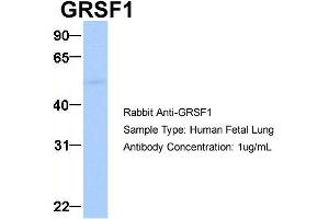 Western Blotting (WB) image for anti-G-Rich RNA Sequence Binding Factor 1 (GRSF1) (Middle Region) antibody (ABIN2778788)