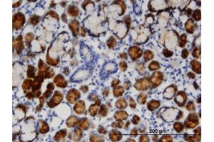 Immunostaining (ISt) image for anti-Transcobalamin I (Vitamin B12 Binding Protein, R Binder Family) (TCN1) (AA 1-423) antibody (ABIN520794)
