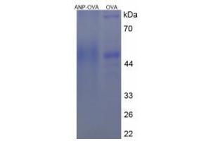 Image no. 1 for Natriuretic Peptide A (NPPA) peptide (Ovalbumin) (ABIN5666089)