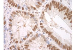 anti-Splicing Factor 3a, Subunit 3, 60kDa (SF3A3) (AA 451-501) antibody