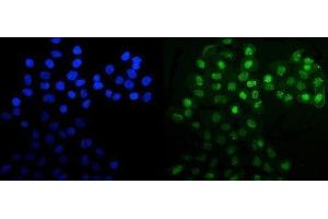 IF analysis of MNAT1 using anti-MNAT1 antibody (ABIN3043583).
