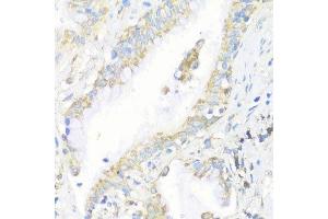 Immunohistochemistry (Paraffin-embedded Sections) (IHC (p)) image for anti-Eukaryotic Translation Initiation Factor 3 Subunit J (EIF3S1) (AA 1-258) antibody (ABIN6140070)