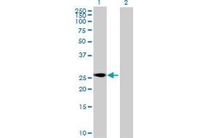 Western Blot analysis of SFRS9 expression in transfected 293T cell line by SFRS9 MaxPab polyclonal antibody. (SFRS9 Antikörper  (AA 1-221))