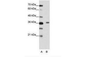 Image no. 2 for anti-BTB (POZ) Domain Containing 6 (BTBD6) (AA 87-136) antibody (ABIN202456)