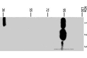 Western blot analysis of Mouse stomach tissue, 293T and Jurkat cell, using PLA2G4B Polyclonal Antibody at dilution of 1:1400 (PLA2G4B Antikörper)