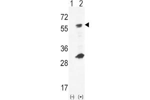 Western Blotting (WB) image for anti-Glucokinase (Hexokinase 4) (GCK) antibody (ABIN5023820) (GCK Antikörper)