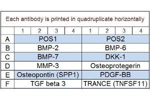 Image no. 1 for Human Bone Metabolism Array Q2 (ABIN4956025)