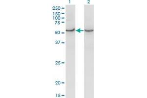 Western Blot analysis of COX15 expression in transfected 293T cell line by COX15 monoclonal antibody (M01), clone 2D2. (COX15 Antikörper  (AA 92-152))