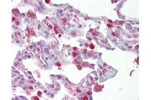 Anti-FOSL1 / FRA1 antibody IHC of human lung. (FOSL1 Antikörper  (AA 143-192))