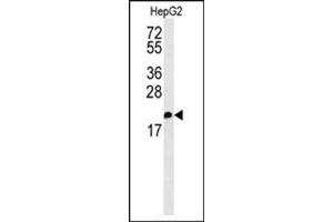 Western blot analysis in HepG2 cell line lysates (35 ug/lane) using S100Z Antibody (Center) Cat. (S100Z Antikörper  (N-Term))