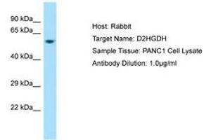 Image no. 1 for anti-D-2-Hydroxyglutarate Dehydrogenase (D2HGDH) (AA 332-381) antibody (ABIN6750028) (D2HGDH Antikörper  (AA 332-381))