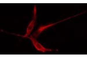 ABIN6275362 staining HeLa cells by IF/ICC. (Plakophilin 2 Antikörper  (N-Term))