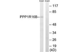 Western blot analysis of extracts from mouse brain cells, using PPP1R16B Antibody. (PPP1R16B Antikörper  (AA 364-413))