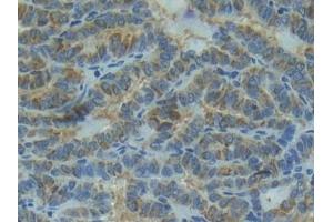 Immunohistochemistry (IHC) image for anti-Interleukin 1 Receptor, Type I (IL1R1) (AA 21-109) antibody (ABIN7430735)