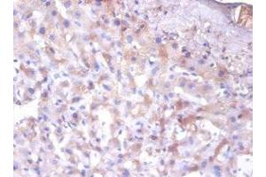 Immunohistochemistry of paraffin-embedded human liver tissue using ABIN7151681 at dilution of 1:100 (ERP29 Antikörper  (AA 40-251))