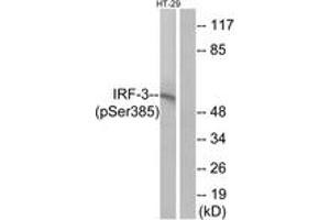 Western blot analysis of extracts from HT29 cells treated with INSULIN 0. (IRF3 Antikörper  (pSer385))